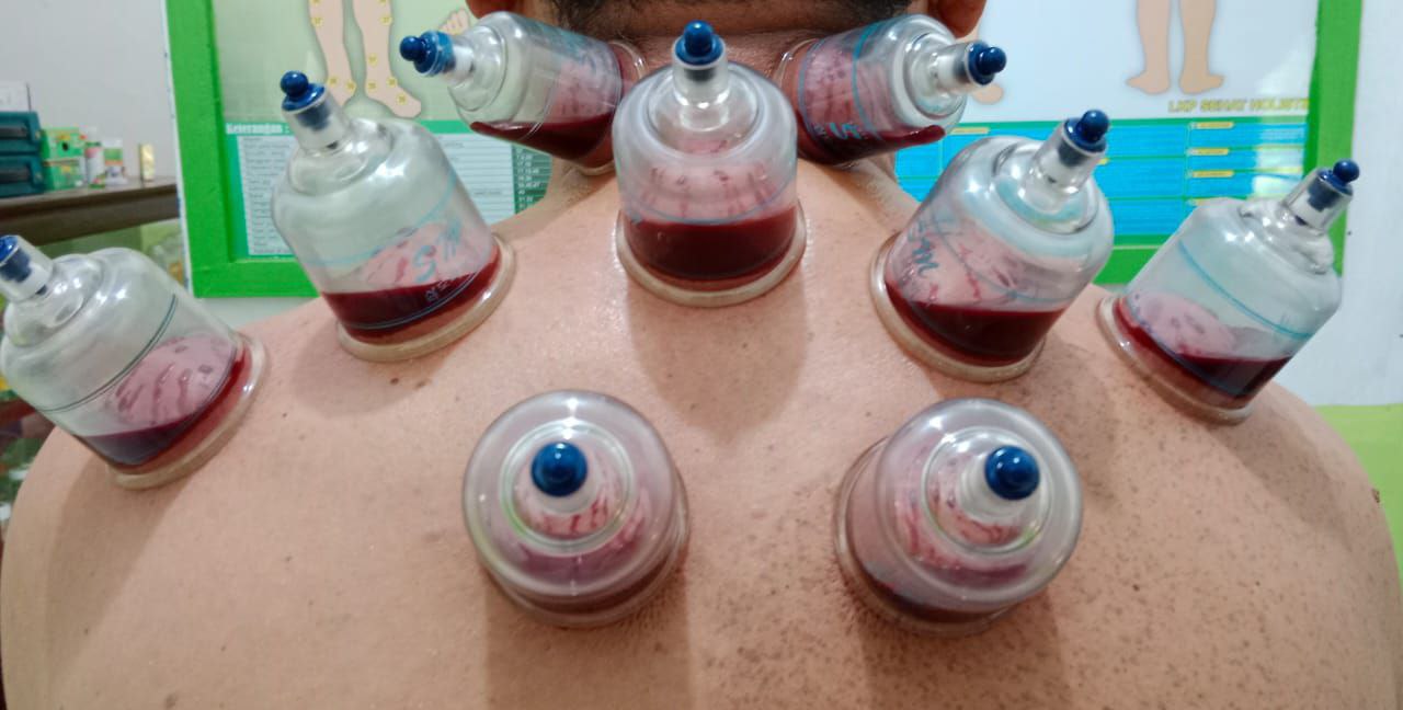 Rumah bekam tanah merah